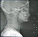 Head X-ray