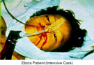 Ebola patient